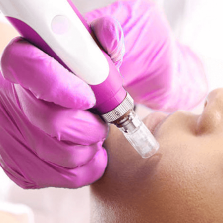 Dermapen Dermapen